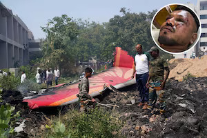 Air India 787 accident: Miracle of '11A' saved from the well of death, 241 died, one person survived