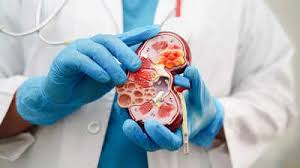Kidney Damage Symptoms: These 4 signs appear in the morning when the kidney is damaged, ignoring them can increase the problem