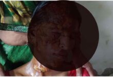 पीलीभीत, बरखेड़ा, विवाहिता, महिला उत्पीड़न, घरेलू हिंसा, पेट्रोल हमला, क्राइम न्यूज, उत्तर प्रदेश, एफआईआर, पुलिस जांच, शाहजहांपुर, महिला सुरक्षा, पीलीभीत विवाहिता पेट्रोल हमला, पीलीभीत समाचार, विवाहिता पर पेट्रोल हमला, घरेलू हिंसा मामला, बरखेड़ा थाना, पीलीभीत क्राइम न्यूज, दहेज प्रताड़ना, महिला उत्पीड़न, यूपी क्राइम न्यूज, शाहजहांपुर ससुराल विवाद, एफआईआर की मांग