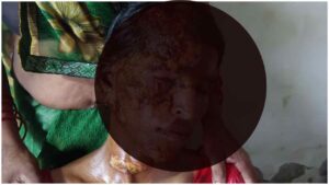 पीलीभीत, बरखेड़ा, विवाहिता, महिला उत्पीड़न, घरेलू हिंसा, पेट्रोल हमला, क्राइम न्यूज, उत्तर प्रदेश, एफआईआर, पुलिस जांच, शाहजहांपुर, महिला सुरक्षा, पीलीभीत विवाहिता पेट्रोल हमला, पीलीभीत समाचार, विवाहिता पर पेट्रोल हमला, घरेलू हिंसा मामला, बरखेड़ा थाना, पीलीभीत क्राइम न्यूज, दहेज प्रताड़ना, महिला उत्पीड़न, यूपी क्राइम न्यूज, शाहजहांपुर ससुराल विवाद, एफआईआर की मांग