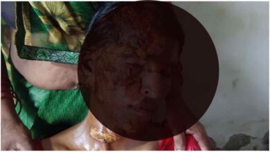 पीलीभीत, बरखेड़ा, विवाहिता, महिला उत्पीड़न, घरेलू हिंसा, पेट्रोल हमला, क्राइम न्यूज, उत्तर प्रदेश, एफआईआर, पुलिस जांच, शाहजहांपुर, महिला सुरक्षा, पीलीभीत विवाहिता पेट्रोल हमला, पीलीभीत समाचार, विवाहिता पर पेट्रोल हमला, घरेलू हिंसा मामला, बरखेड़ा थाना, पीलीभीत क्राइम न्यूज, दहेज प्रताड़ना, महिला उत्पीड़न, यूपी क्राइम न्यूज, शाहजहांपुर ससुराल विवाद, एफआईआर की मांग